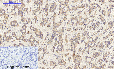 IHC - Bad Polyclonal Antibody AP68618